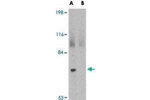 Western blot analysis of JPH2 in 293 cell lysate with JPH2 polyclonal antibody  at 2 ug/mL in (A) the absence and (B) the presence of blocking peptide. (Junctophilin 2 Antikörper  (C-Term))