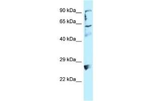 WB Suggested Anti-LIMA1 Antibody Titration: 1. (LIMA1 Antikörper  (C-Term))