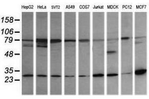Image no. 4 for anti-RAB21, Member RAS Oncogene Family (RAB21) antibody (ABIN1500545) (RAB21 Antikörper)