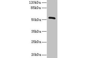 Western blot All lanes: ZNF410 antibody at 3 μg/mL + Mouse brain tissue Secondary Goat polyclonal to rabbit IgG at 1/10000 dilution Predicted band size: 53, 30, 48, 45, 56 kDa Observed band size: 53 kDa (ZNF41 Antikörper  (AA 1-300))