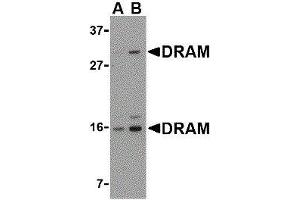 Western Blotting (WB) image for anti-DNA-Damage Regulated Autophagy Modulator 1 (DRAM1) (C-Term) antibody (ABIN2473364) (DRAM Antikörper  (C-Term))