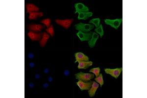 Phospho-SNAIL (Ser11) Antibody staining Hela cells(heat shock treatment) by IF/ICC. (SNAIL Antikörper  (pSer11))