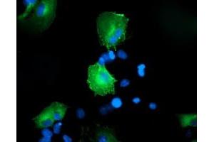Anti-CCM2 mouse monoclonal antibody (ABIN2454939) immunofluorescent staining of COS7 cells transiently transfected by pCMV6-ENTRY CCM2 (RC201418). (CCM2 Antikörper)