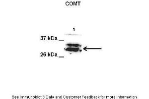 Lanes:   1. (COMT Antikörper  (Middle Region))