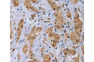 Immunohistochemistry (IHC) image for anti-C-Type Lectin Domain Family 1, Member A (CLEC1A) antibody (ABIN2427969) (CLEC1A Antikörper)
