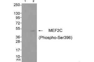 Western blot analysis of extracts from cos-7 cells (Lane 2), using MEF2C (Phospho-Ser396) Antibody. (MEF2C Antikörper  (pSer396))