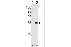 Western blot analysis of CK1G (arrow) using rabbit polyclonal CK1G (Center ) Antibody (ABIN391377 and ABIN2841388). (CAMK1G Antikörper  (AA 211-241))