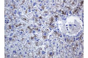 Image no. 10 for anti-Cadherin 1, Type 1, E-Cadherin (Epithelial) (CDH1) antibody (ABIN1497941) (E-cadherin Antikörper)