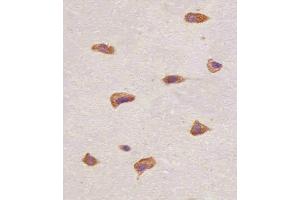(ABIN6243222 and ABIN6577089) staining FGFR1 in human brain tissue sections by Immunohistochemistry (IHC-P - paraformaldehyde-fixed, paraffin-embedded sections). (FGFR1 Antikörper  (C-Term))