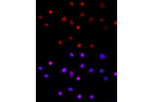 Immunofluorescence (IF) image for anti-Leo1, Paf1/RNA Polymerase II Complex Component, Homolog (S. Cerevisiae) (LEO1) antibody (ABIN6133790)