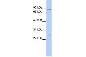 WB Suggested Anti-ZNF613 Antibody Titration:  0. (ZNF613 Antikörper  (N-Term))
