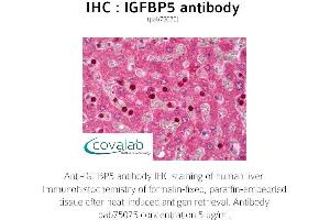 Image no. 1 for anti-Insulin-Like Growth Factor Binding Protein 5 (IGFBP5) (AA 192-206) antibody (ABIN1735787) (IGFBP5 Antikörper  (AA 192-206))