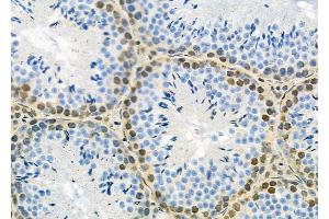 ABIN6263195 and ABIN6279528 at 1/100 staining Rat brain tissue by IHC-P. (MED29 Antikörper  (Internal Region))