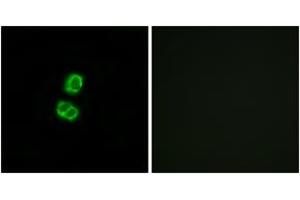 Immunofluorescence analysis of MCF7 cells, using FGF22 Antibody. (FGF22 Antikörper  (AA 71-120))