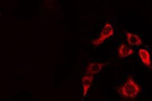 ABIN6274948 staining HepG2 cells by IF/ICC. (CLIP2 Antikörper  (C-Term))