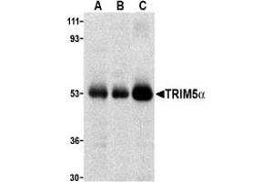 Image no. 2 for anti-Tripartite Motif Containing 5 (TRIM5) (C-Term) antibody (ABIN203830) (TRIM5 Antikörper  (C-Term))