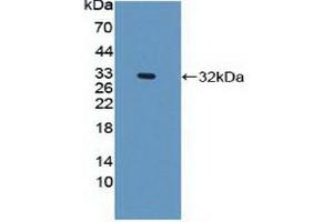 Western blot analysis of recombinant Human PLEC. (PLEC Antikörper  (AA 175-400))