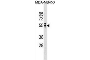 Western Blotting (WB) image for anti-T Antigen antibody (ABIN3001361) (T Antigen Antikörper)