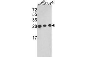 Western blot analysis of TPI1 Antibody (TPI1 Antikörper  (C-Term))