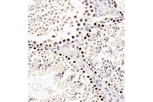 Immunohistochemistry of paraffin embedded mouse testis using sav1 (ABIN7075505) at dilution of 1:200 (400x lens) (SAV1 Antikörper)