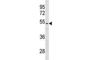 PTEN antibody western blot analysis in NCI-H460 lysate. (PTEN Antikörper  (AA 361-390))