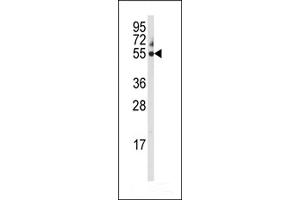 Western blot analysis of anti-CYP3A5 Antibody in 293 cell line lysates (35ug/lane) (CYP3A5 Antikörper  (C-Term))