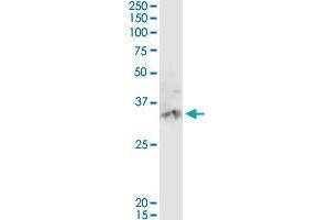 CA3 MaxPab rabbit polyclonal antibody. (CA3 Antikörper  (AA 1-260))