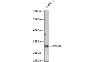 Western blot analysis of extracts of U-87MG cells using GPM6A Polyclonal Antibody at dilution of 1:1000. (GPM6A Antikörper)