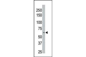The anti-M1D Pab (ABIN392853 and ABIN2842271) is used in Western blot to detect M1D in 293 cell lysate. (PPM1D Antikörper  (C-Term))