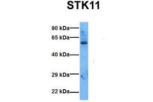 Host:  Rabbit  Target Name:  STK11  Sample Tissue:  Human 293T  Antibody Dilution:  1. (LKB1 Antikörper  (N-Term))