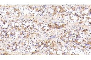 Detection of IL17RD in Human Stomach Tissue using Polyclonal Antibody to Interleukin 17 Receptor D (IL17RD) (IL17RD Antikörper  (AA 157-299))