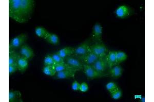 Immunofluorescence staining of Hela cells with ABIN7162407 at 1:50, counter-stained with DAPI. (OSBPL7 Antikörper  (AA 1-249))