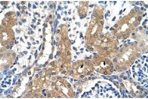 Immunohistochemical staining (Formalin-fixed paraffin-embedded sections) of human kidney with CYP4A22 polyclonal antibody  at 4-8 ug/mL working concentration. (CYP4A22 Antikörper  (N-Term))