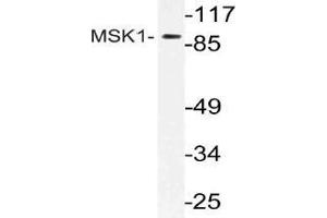 Western blot (WB) analysis of MSK1 antibody in extracts from mouse brain cells. (MSK1 Antikörper)