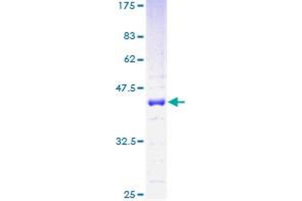 HMGN1 Protein (AA 1-100) (GST tag)