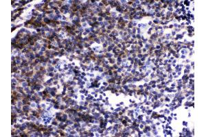 Immunohistochemistry (IHC) image for anti-Lymphocyte-Specific Protein tyrosine Kinase (LCK) (AA 468-506), (C-Term) antibody (ABIN3043870)