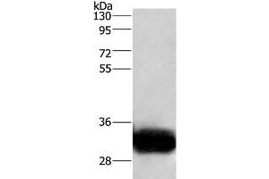 Western Blot analysis of Human fetal brain tissue using GPM6A Polyclonal Antibody at dilution of 1:950 (GPM6A Antikörper)