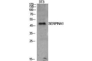 Western Blotting (WB) image for anti-AAT (Internal Region) antibody (ABIN3181415) (AAT (Internal Region) Antikörper)