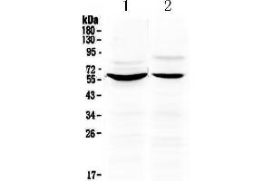 Western blot analysis of KPNA2 using anti-KPNA2 antibody . (KPNA2 Antikörper  (N-Term))