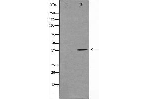Western blot analysis on COLO205 cell lysate using TUSC3 Antibody,The lane on the left is treated with the antigen-specific peptide. (TUSC3 Antikörper  (Internal Region))