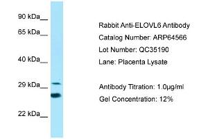 Western Blotting (WB) image for anti-ELOVL Fatty Acid Elongase 6 (ELOVL6) (N-Term) antibody (ABIN2789880) (ELOVL6 Antikörper  (N-Term))