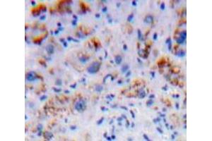 Used in DAB staining on fromalin fixed paraffin-embedded Liver tissue (Nicastrin Antikörper  (AA 420-655))