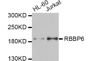 Western blot analysis of extracts of HL60 and Jurkat cell lines, using RBBP6 antibody.