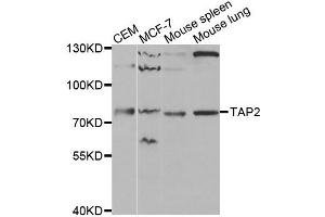 Western blot analysis of extracts of various cell lines, using TAP2 antibody. (TAP2 Antikörper)