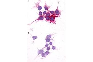 Immunocytochemistry (ICC) staining of HEK293 human embryonic kidney cells transfected (A) or untransfected (B) with P2RY14. (P2RY14 Antikörper  (C-Term))