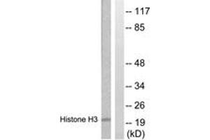 Western blot analysis of extracts from HuvEc cells, treated with Serum 20% 30', using Histone H3 (Ab-28) Antibody. (Histone 3 Antikörper  (AA 13-62))