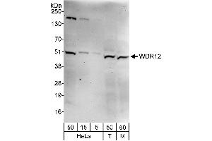 anti-WD Repeat Domain 12 (WDR12) (AA 373-423) antibody