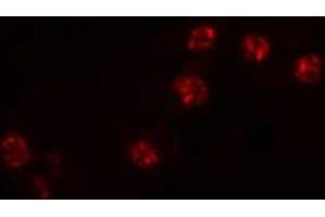 ABIN6274516 staining NIH-3T3 cells by IF/ICC.