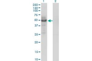 Western Blotting (WB) image for anti-Phospholipid Transfer Protein (PLTP) (AA 1-422) antibody (ABIN466078) (PLTP Antikörper  (AA 1-422))