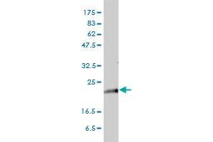 Western Blotting (WB) image for anti-GTPase Kras (KRAS) (AA 1-188) antibody (ABIN561621)